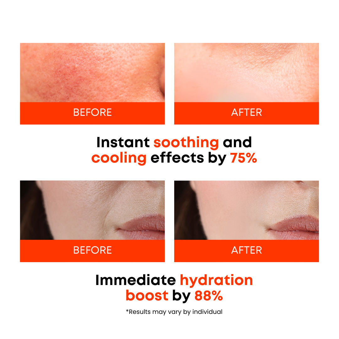 SOMISOME Carrot Calming Toner Pads 40 Pads