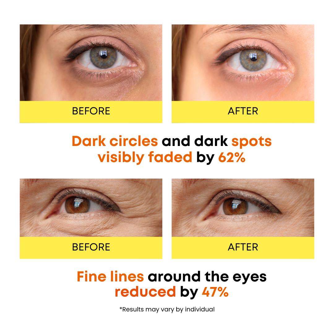 SOMISOME 360° Vitamin C Eye Masks 50 Masks