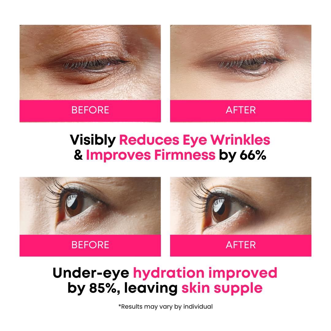 SOMISOME 360° Collagen Eye Masks 50 Masks