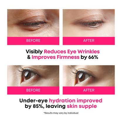 SOMISOME 360° Collagen Eye Masks 50 Masks